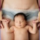 Tratamiento cicatrices postparto